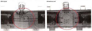 Radiografie bobine Beru